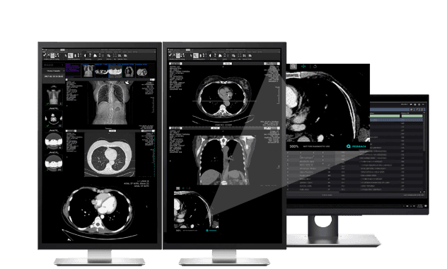 NexusLink Med Image Analysis